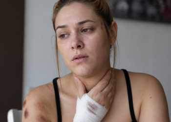 Relato escalofriante de una mujer agredida por dos dogos en Trelew: “Sólo rogaba que no me maten”