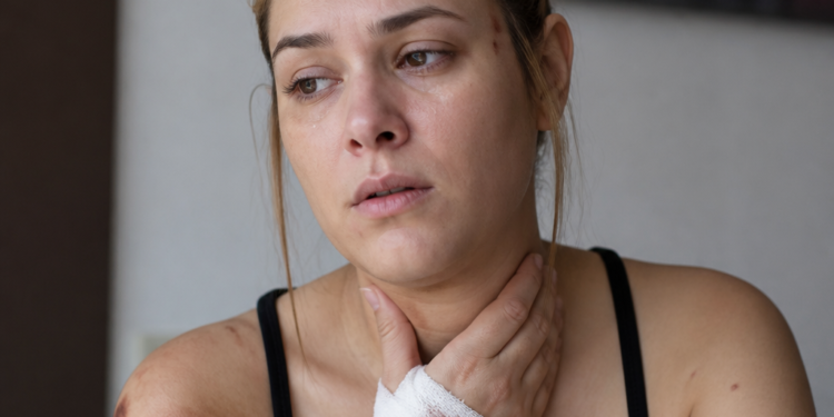 Relato escalofriante de una mujer agredida por dos dogos en Trelew: “Sólo rogaba que no me maten”